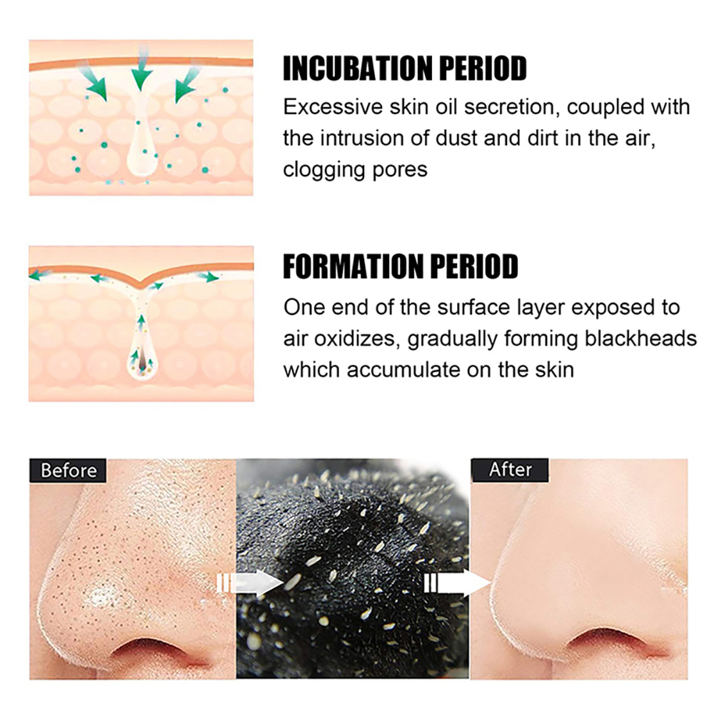 Blackhead Remover Nasal Strips - Nasal Aspirator ulasan dan harga